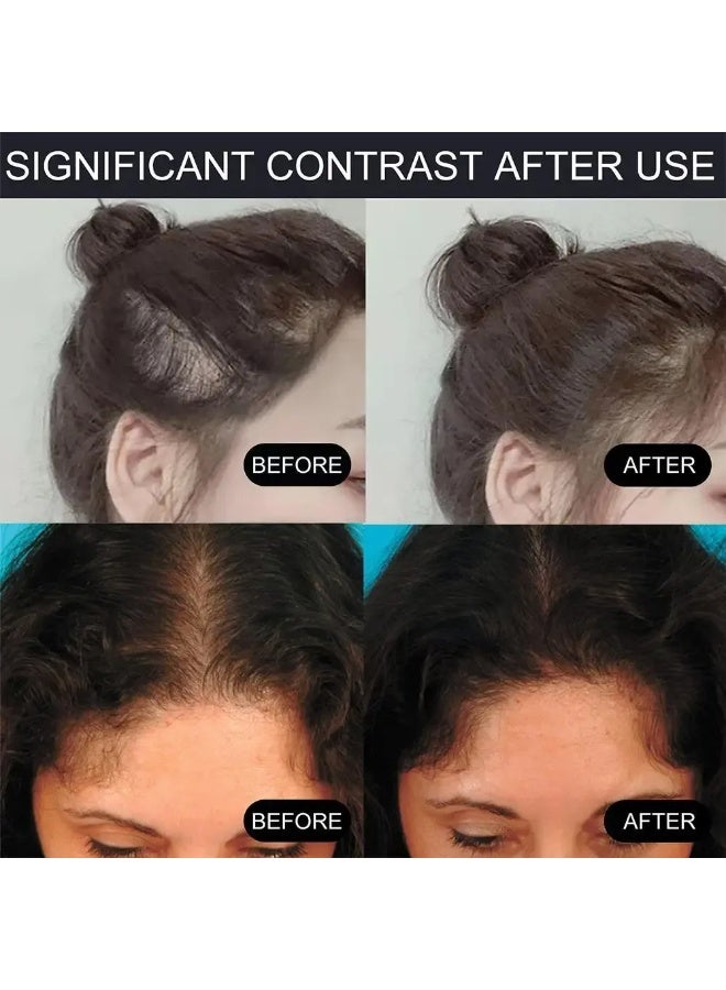 EELHOE Root Cover Up & Hairline Powder for Thinning Hair, Waterproof, Hair Line Powder Set Makeups Natural Fluffy Thin Hairline (Rosy brown) - Image 3